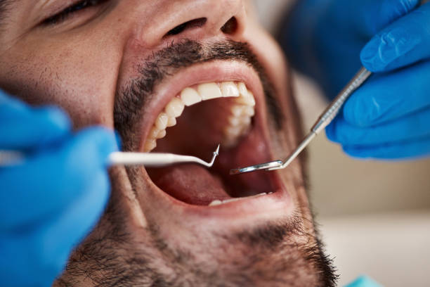 Best Emergency Treatment for Oral Infections in Avodo Heights, CA
