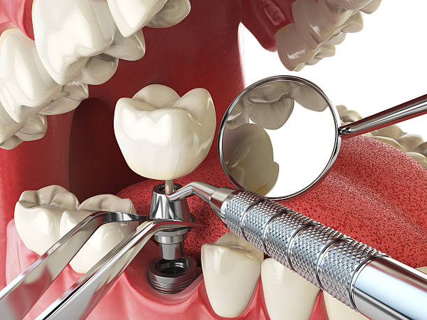Best Emergency Treatment for Jaw Pain or Injury in Avodo Heights, CA